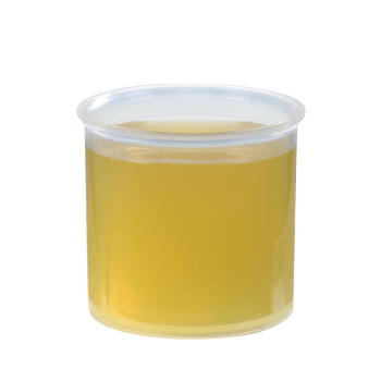 Schoenenberger Zwiebel